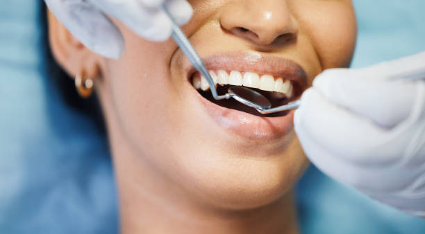 Best Emergency Dental Care for Broken or Chipped Teeth in Grafton, WI