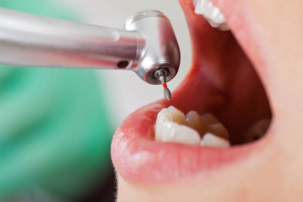 Best Emergency Dental Care for Broken or Chipped Teeth in Grafton, WI
